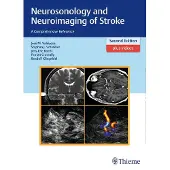 Neurosonology and Neuroimaging of Stroke: A Comprehensive Reference